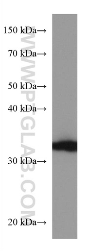 [67498-1-IG-150UL] AKR1B1 Monoclonal antibody
