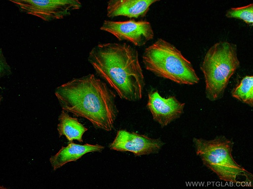 [67499-1-IG-150UL] PRDX6 Monoclonal antibody