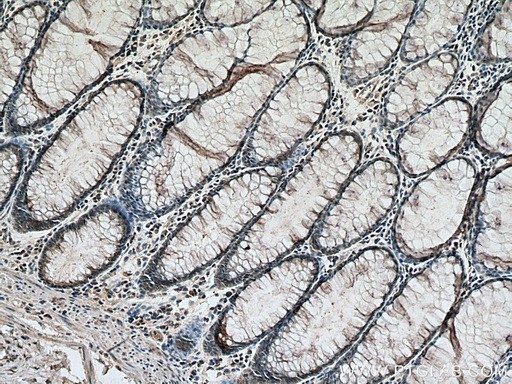 [67500-1-IG-20UL] RAN Monoclonal antibody
