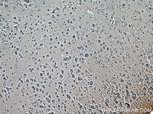 [67501-1-IG-20UL] RAB2A Monoclonal antibody