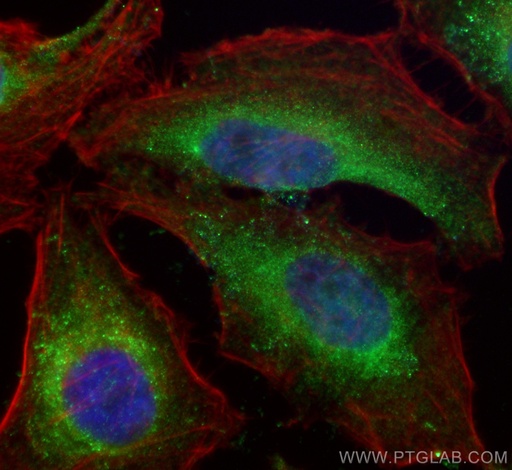 [67502-1-IG-20UL] RHOBTB3 Monoclonal antibody