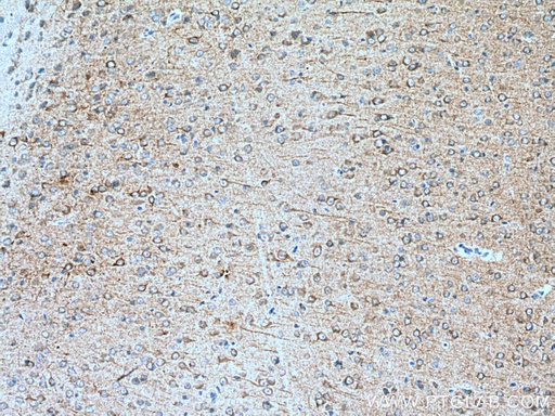 [67503-1-IG-150UL] CDK5R1 Monoclonal antibody