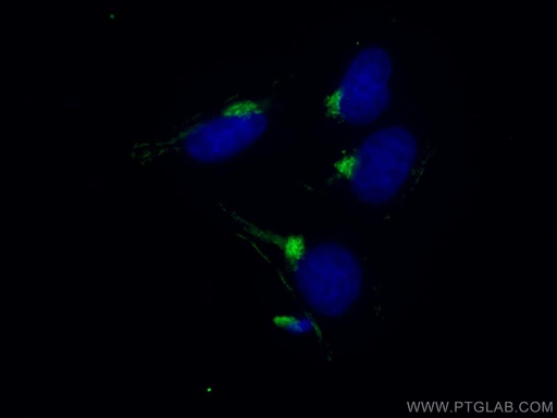 [67505-1-IG-150UL] TMF1 Monoclonal antibody