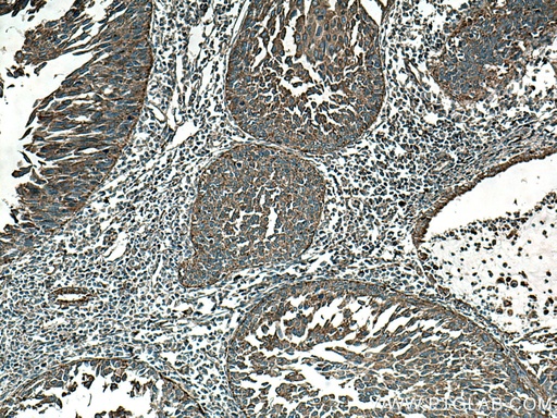 [67512-1-IG-150UL] BSEP Monoclonal antibody