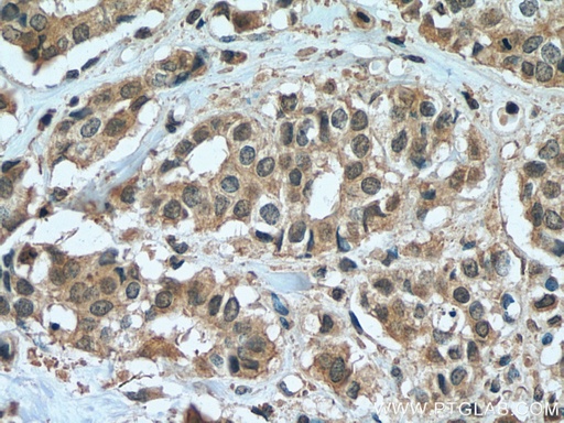 [67514-1-IG-150UL] ZEB2 Monoclonal antibody