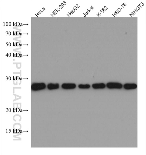 [67515-1-IG-20UL] TPI1 Monoclonal antibody