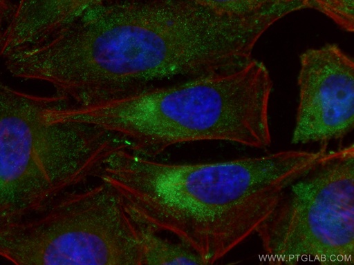 [67518-1-IG-150UL] HPRT1 Monoclonal antibody