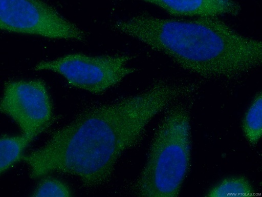 [67519-1-IG-20UL] CMPK1 Monoclonal antibody