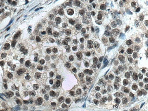 [67520-1-IG-20UL] PDS5A Monoclonal antibody