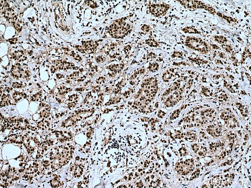 [67525-1-IG-20UL] IPO7 Monoclonal antibody