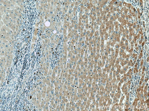[67532-1-IG-20UL] AMT Monoclonal antibody