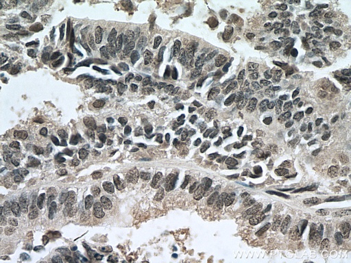 [67541-1-IG-150UL] RBM8A,Y14 Monoclonal antibody