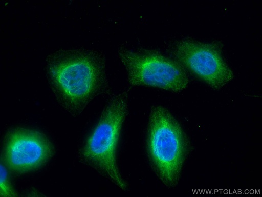 [67545-1-IG-150UL] UAP1 Monoclonal antibody