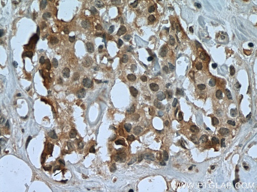[67557-1-IG-20UL] USP15 Monoclonal antibody
