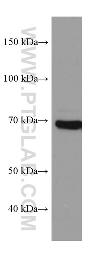 [67562-1-IG-20UL] PAK6 Monoclonal antibody