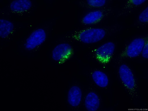 [67566-1-IG-150UL] RPS14 Monoclonal antibody