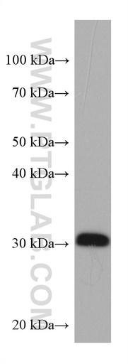 [67567-1-IG-150UL] IGFBP6 Monoclonal antibody