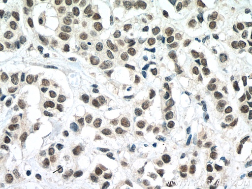 [67569-1-IG-20UL] TAF6L Monoclonal antibody