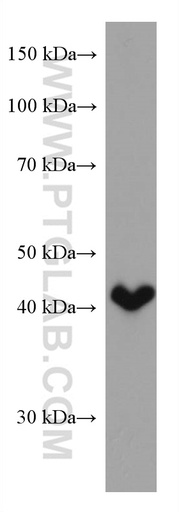 [67572-1-IG-150UL] HSD3B2 Monoclonal antibody