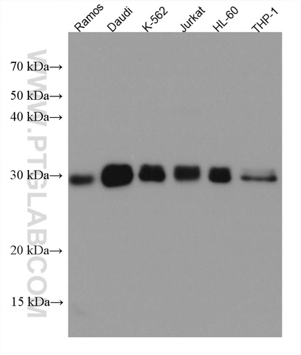 [67576-1-IG-150UL] TGIF2 Monoclonal antibody