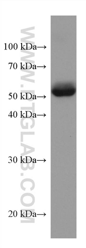 [67577-1-IG-20UL] ANGPTL4 Monoclonal antibody