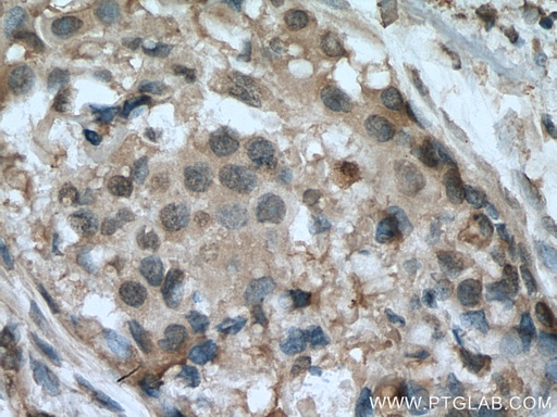 [67583-1-IG-150UL] HINT1 Monoclonal antibody