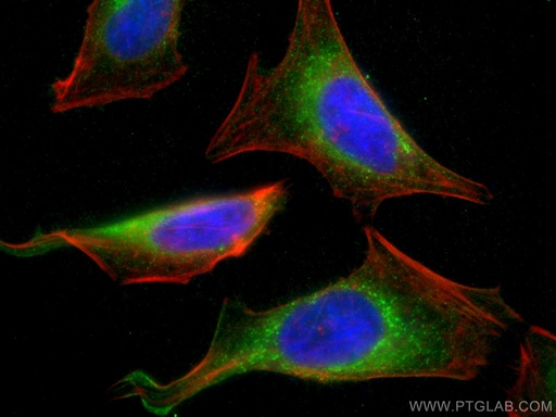 [67585-1-IG-20UL] Calumenin Monoclonal antibody