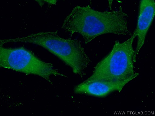 [67586-1-IG-150UL] ATM Monoclonal antibody