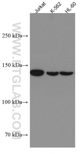 [67587-1-IG-20UL] FMNL1 Monoclonal antibody