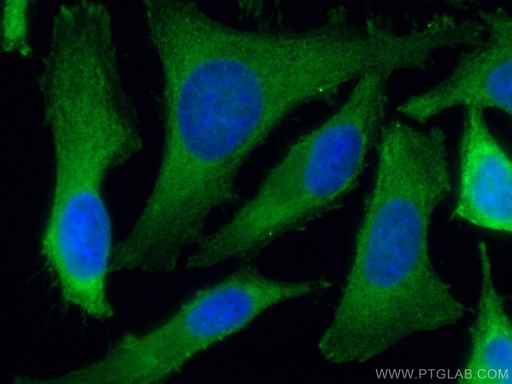 [67591-1-IG-150UL] PHGDH Monoclonal antibody