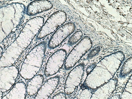 [67597-1-IG-150UL] Importin Beta Monoclonal antibody