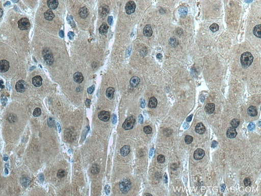 [67598-1-IG-20UL] GSS Monoclonal antibody