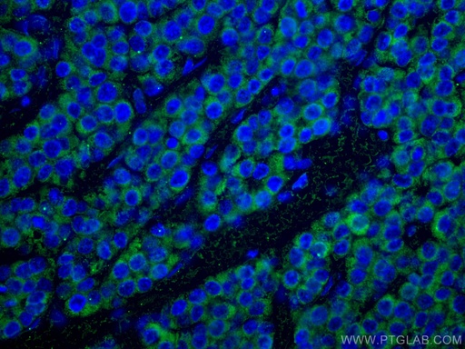 [67600-1-IG-20UL] SDHB Monoclonal antibody