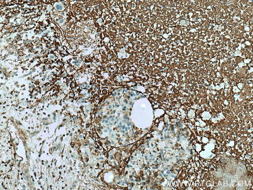 [67604-1-IG-150UL] Collagen Type V Monoclonal antibody