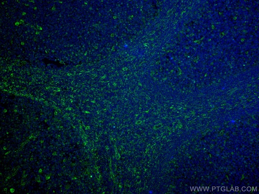 [67605-1-IG-20UL] CD63 Monoclonal antibody