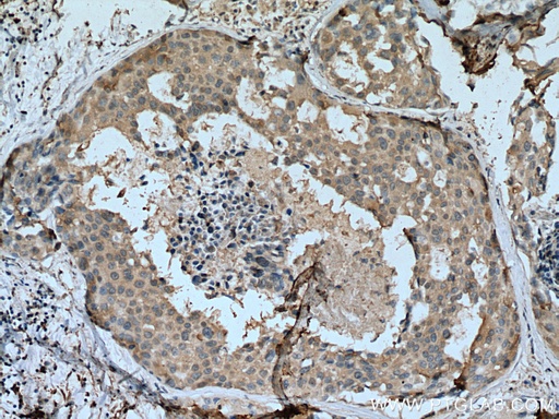 [67606-1-IG-150UL] SCLY Monoclonal antibody