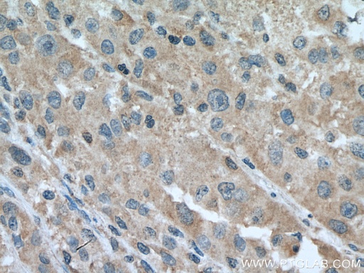 [67607-1-IG-150UL] FAAH Monoclonal antibody