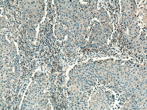 [67619-1-IG-150UL] PSAT1 Monoclonal antibody