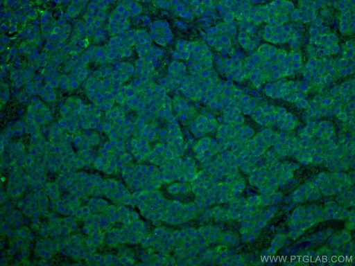 [67620-1-IG-20UL] WASF3 Monoclonal antibody