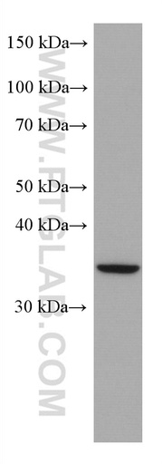 [67622-1-IG-150UL] SIX6 Monoclonal antibody