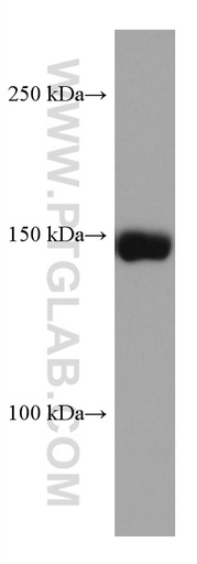 [67630-1-IG-150UL] CPS1 Monoclonal antibody