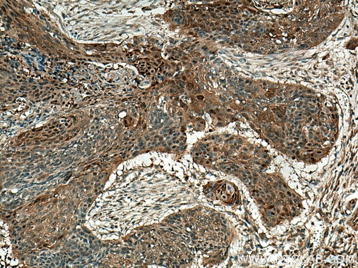 [67633-1-IG-20UL] Maspin Monoclonal antibody