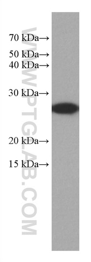 [67634-1-IG-20UL] GSTM3 Monoclonal antibody