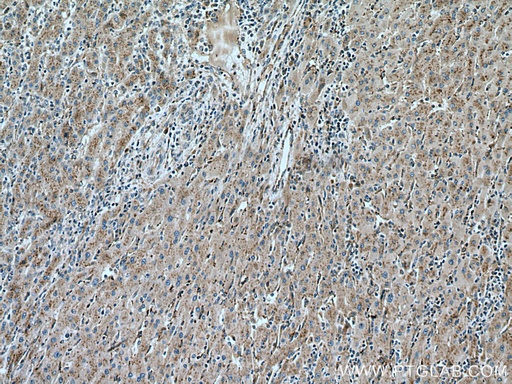[67635-1-IG-150UL] SLC25A17 Monoclonal antibody