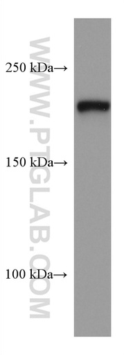 [67640-1-IG-150UL] PHLPP Monoclonal antibody