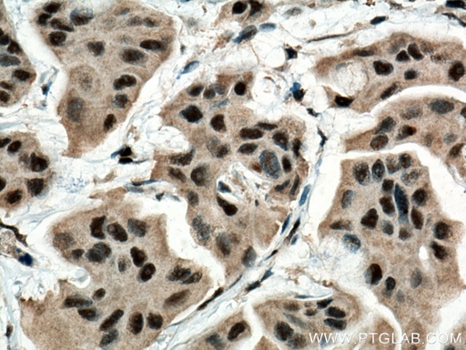 [67641-1-IG-20UL] BAT1 Monoclonal antibody
