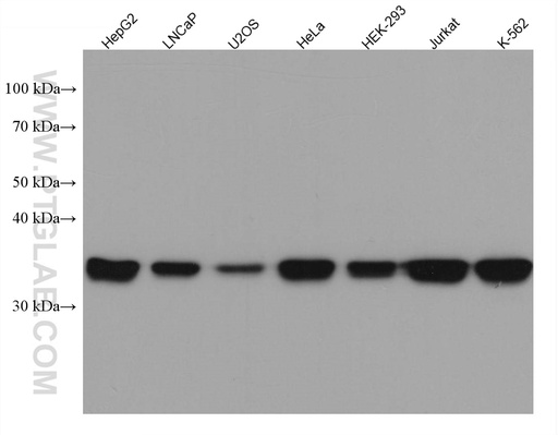 [67643-1-IG-20UL] MAT2B Monoclonal antibody