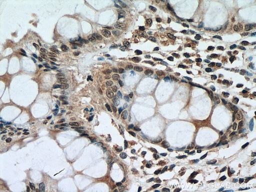 [67644-1-IG-150UL] PI3 Kinase p85 Beta Monoclonal antibody