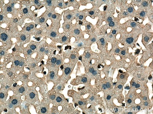 [67645-1-IG-20UL] GSTT1 Monoclonal antibody