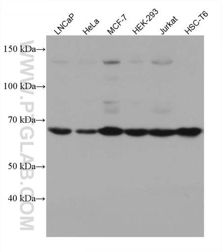 [67646-1-IG-20UL] HDAC10 Monoclonal antibody